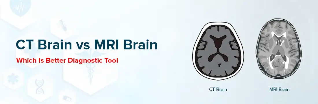 CT Brain Vs MRI Brain: Which Is Better Diagnostic Tool